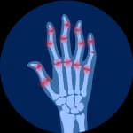 جراحات اليد