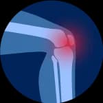 جراحات تغيير المفصل