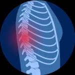 جراحات العمود الفقري