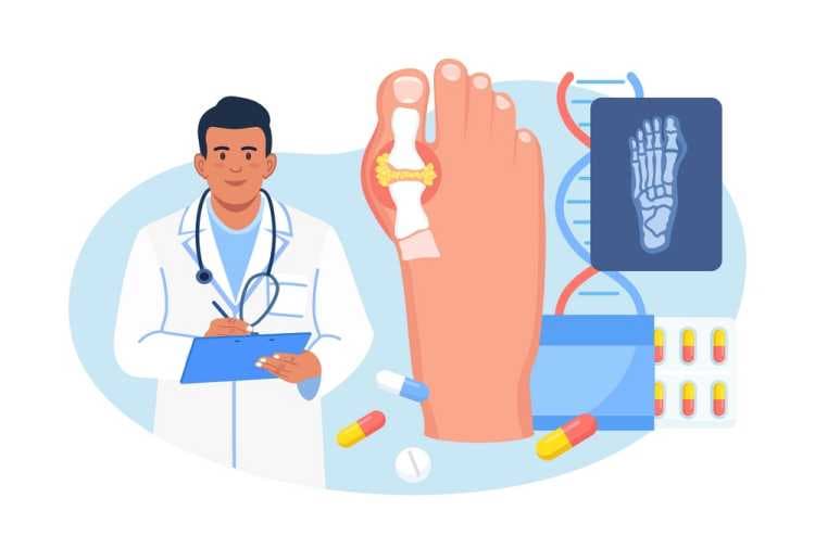 علاج مرض النقرس نهائيا: الطرق الطبية والطبيعية للتخلص من الألم والمضاعفات