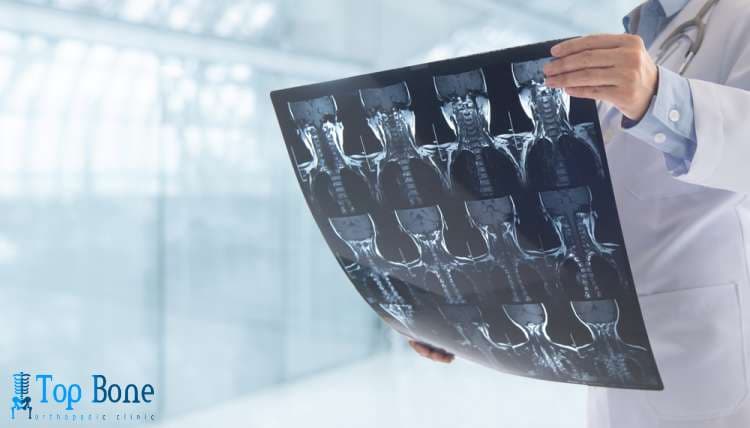 افضل دكتور عظام تخصص ركبة في مصر 2025