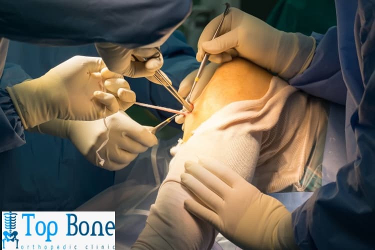 ما هي تكلفة عملية الغضروف الهلالي؟