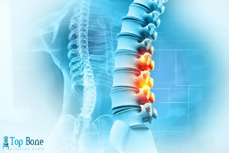 افضل دكتور عمود فقري في القاهرة 2026 | احدث طرق العلاج